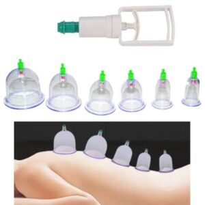 Βεντούζες για παραδοσιακή θεραπεία - Σετ 6 τμχ 0528 OEM